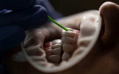 Beneficios de la Periodoncia en Sevilla: Cuidado Integral para la Salud Oral